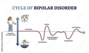 Bipolar disorder swings extreme